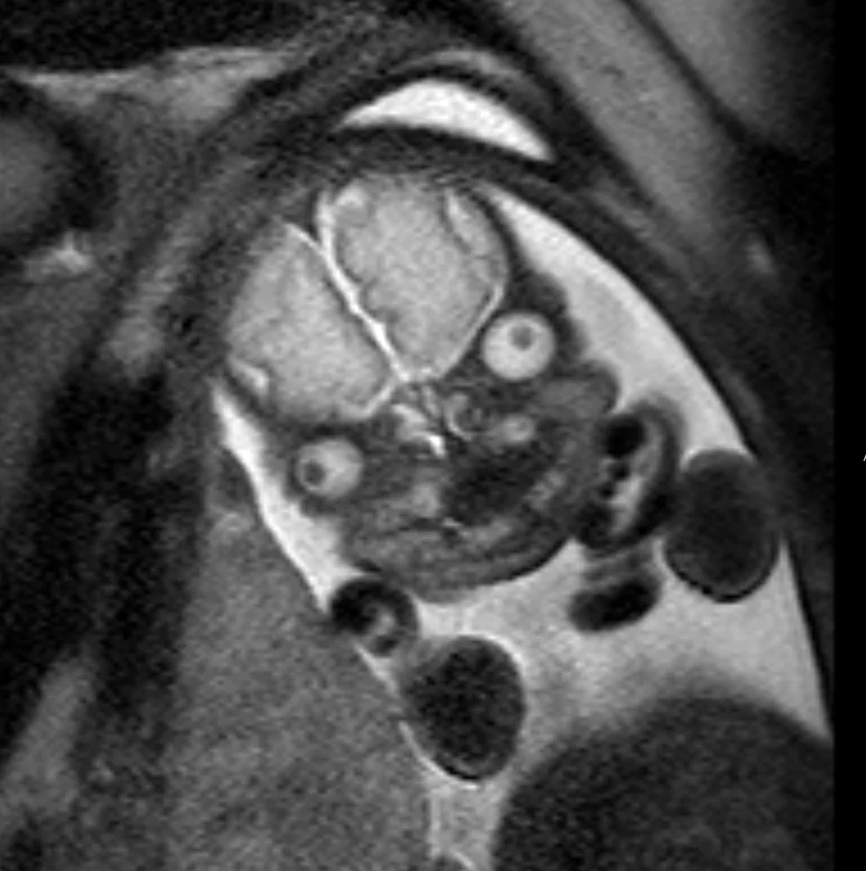 Long case example 1